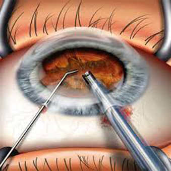 Ophthalmology